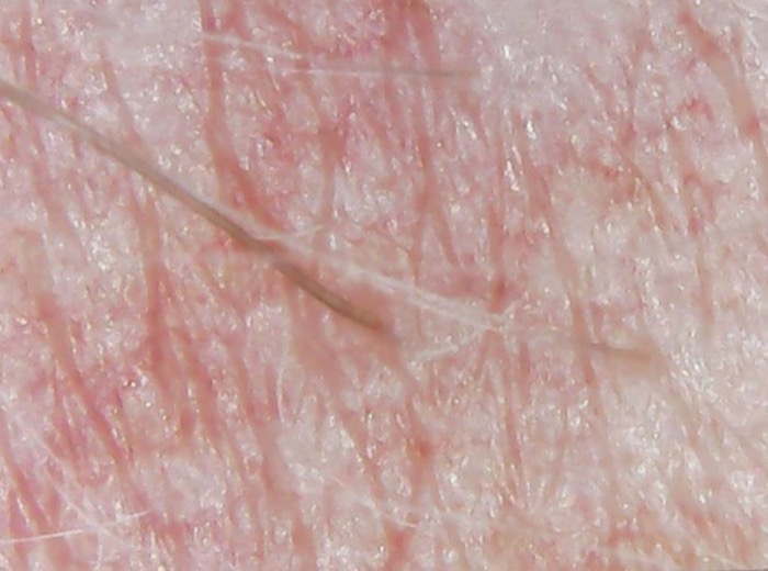 Pelo e cute al microscopio