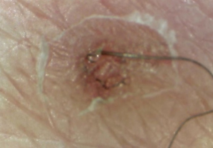 Pelo e cute al microscopio