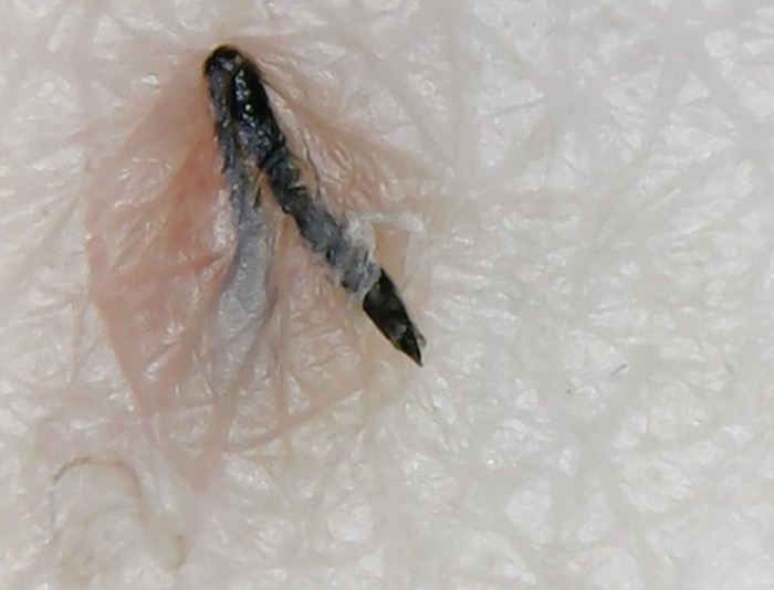 Pelo e cute al microscopio