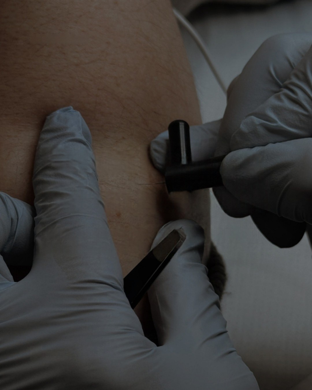 Formazione sul laser Medika