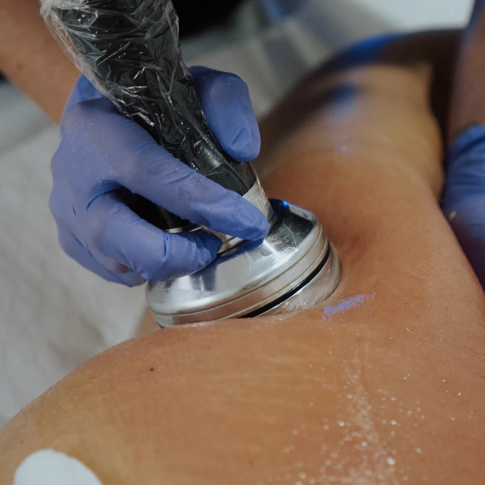 Trattamento corpo con manipolo Medika