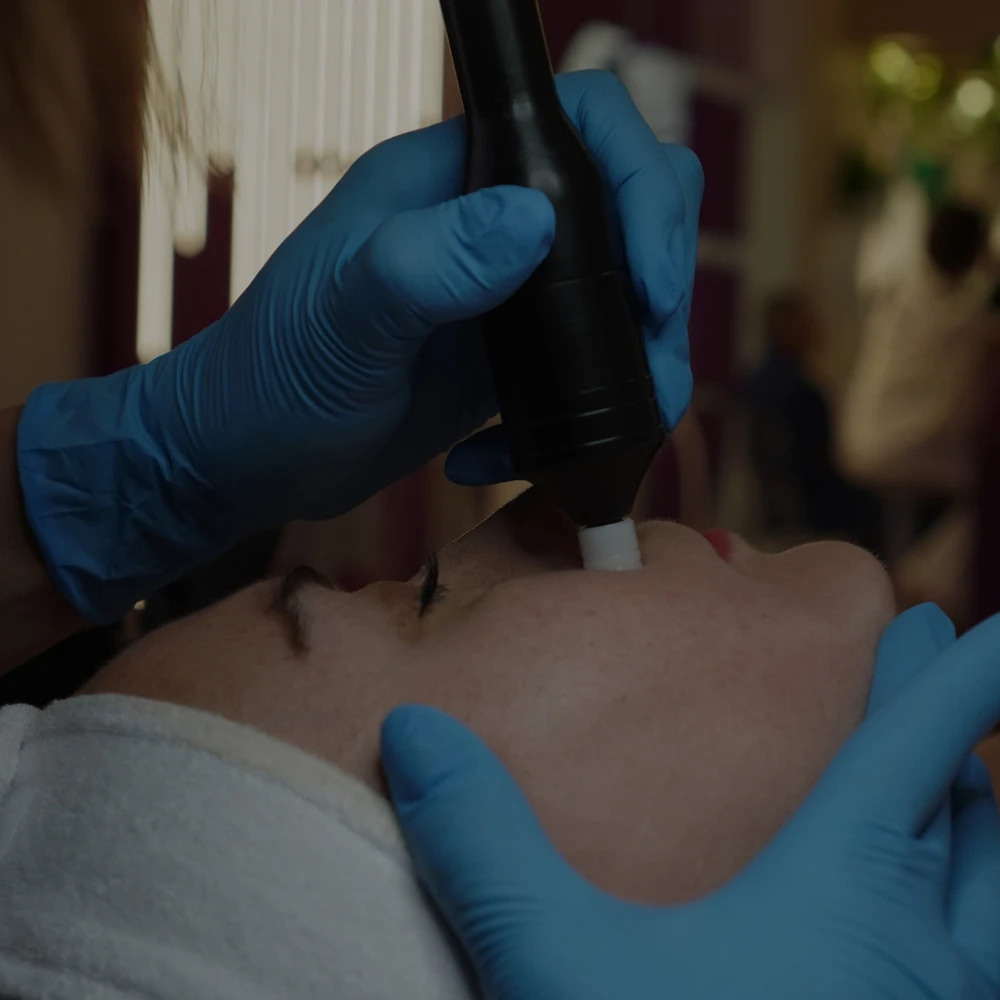 Trattamento viso con manipolo Medika