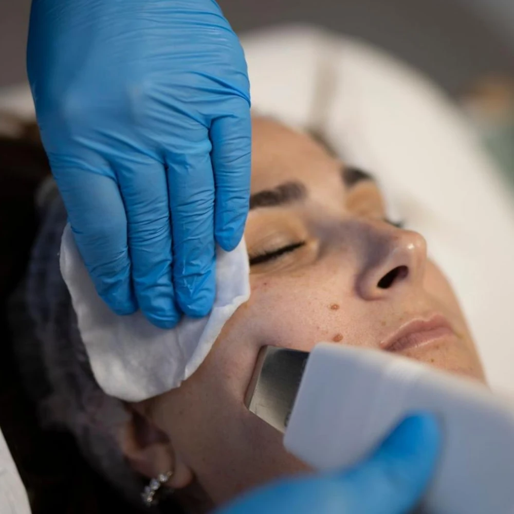 Trattamento viso con spatola a ultrasuoni
